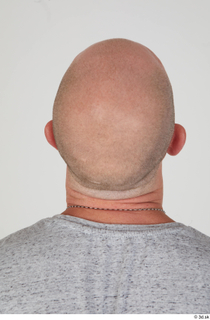 Photos Reece Griffiths bald head 0005.jpg
